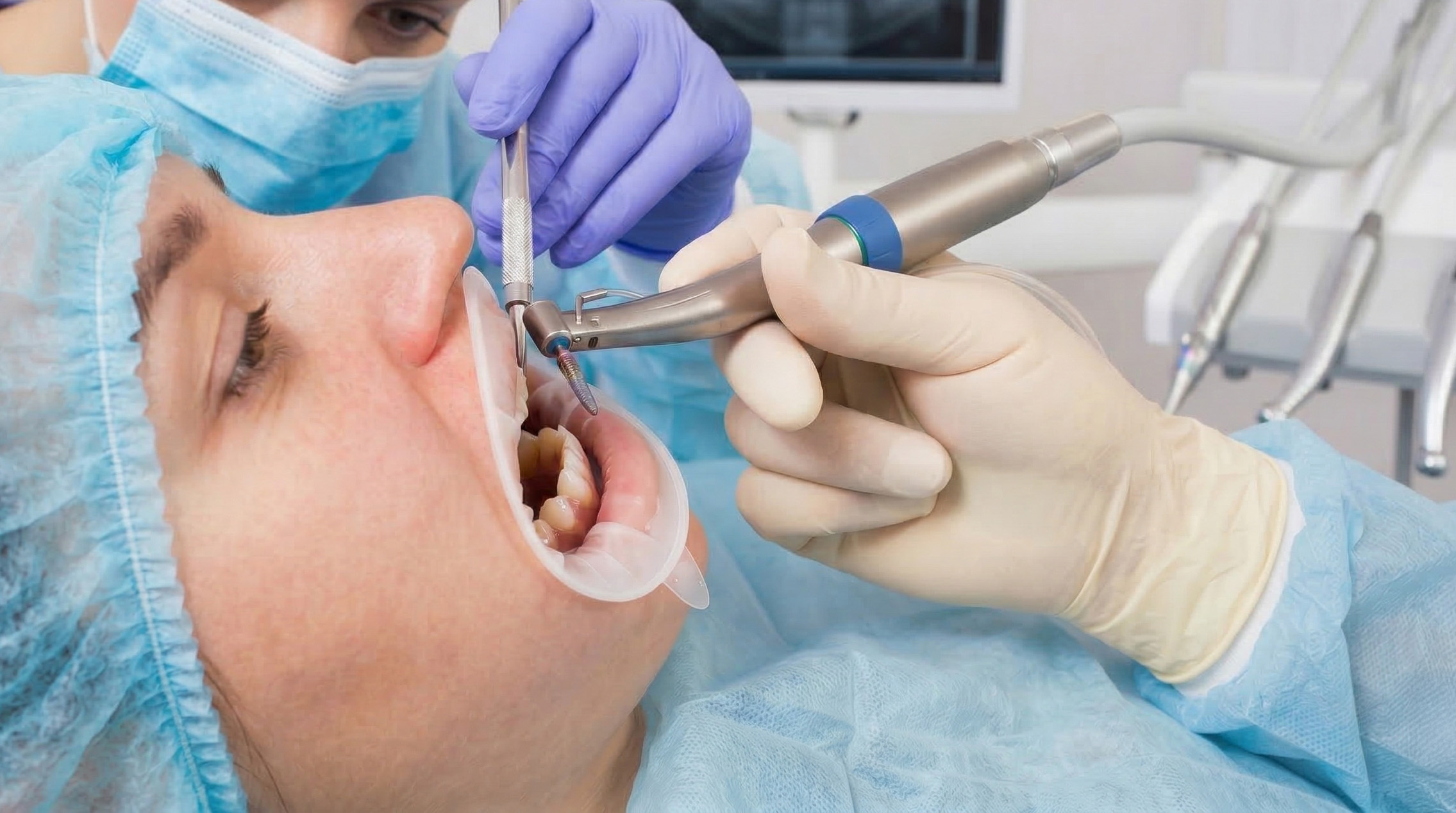 DU fondamental en implantologie