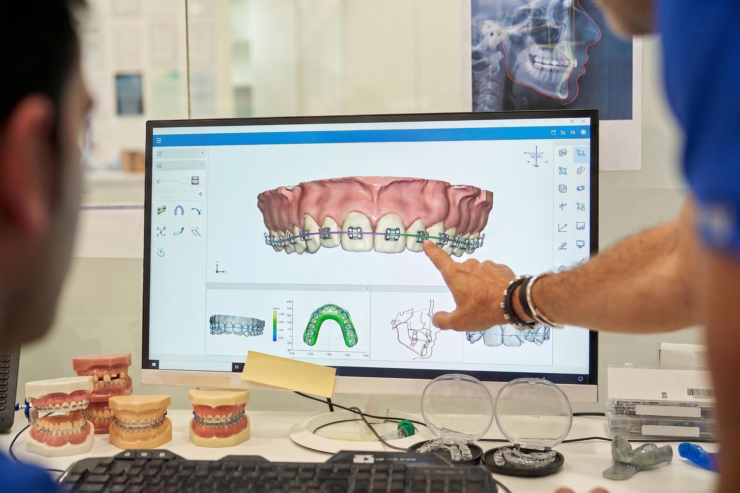 DU d'orthodontie clinique numérique